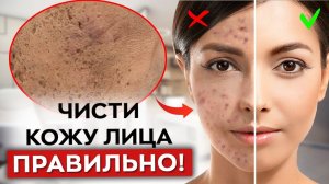 Как ухаживать за лицом? / Это самое ПРАВИЛЬНОЕ очищение кожи!