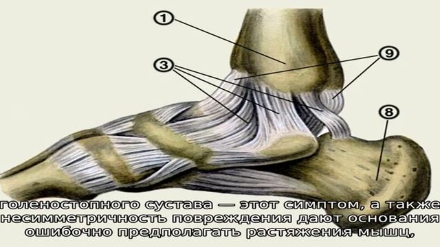 Гигрома в области стопы смотреть онлайн