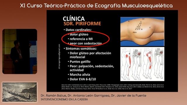 2019 valoración y tratamiento ecoguiado del dolor gluteo profundo смотреть онлайн