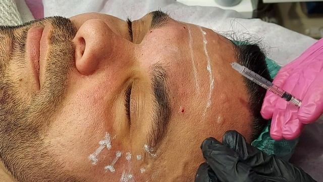 Токсин мужчине. Фрагмент.