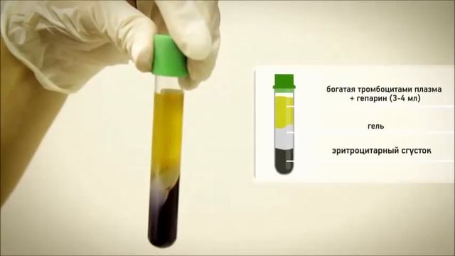 Plasmolifting™ в косметологии — восстановление естественной красоты! смотреть онлайн
