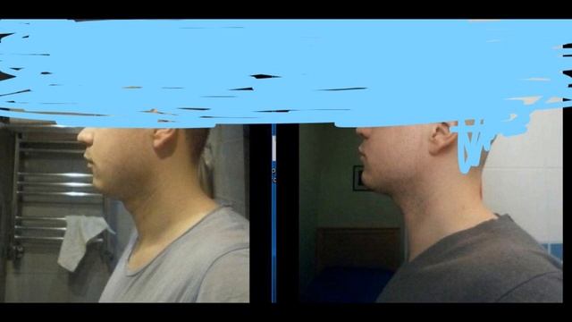 1 год результата мьюинга, объяснения где новые ролики. Mewing по русски. смотреть онлайн