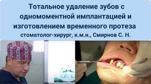 Тотальное удаление зубов с одномоментной имплантацией и изготовлением временного протеза на 4-х импл