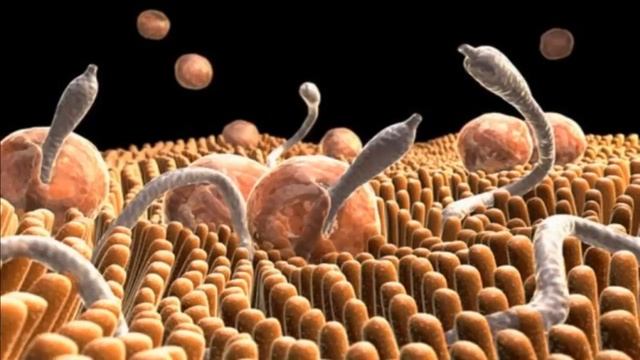 Как узнать есть ли глисты у человека? Как избавиться от глистов? (КОНКУРС) смотреть онлайн