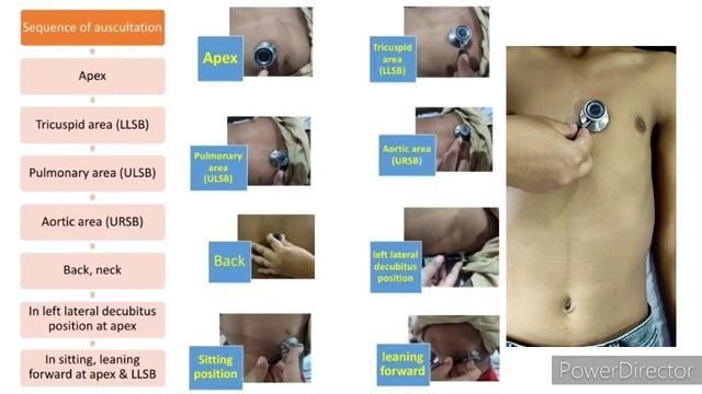Cardio-vascular system (CVS) examination in children | Pediatrics смотреть онлайн