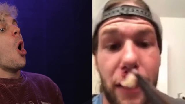 Reacting To The Grossest Pimple Popping Videos