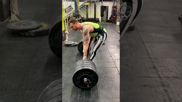 Кифоз, лордоз и сколиоз… смотреть онлайн