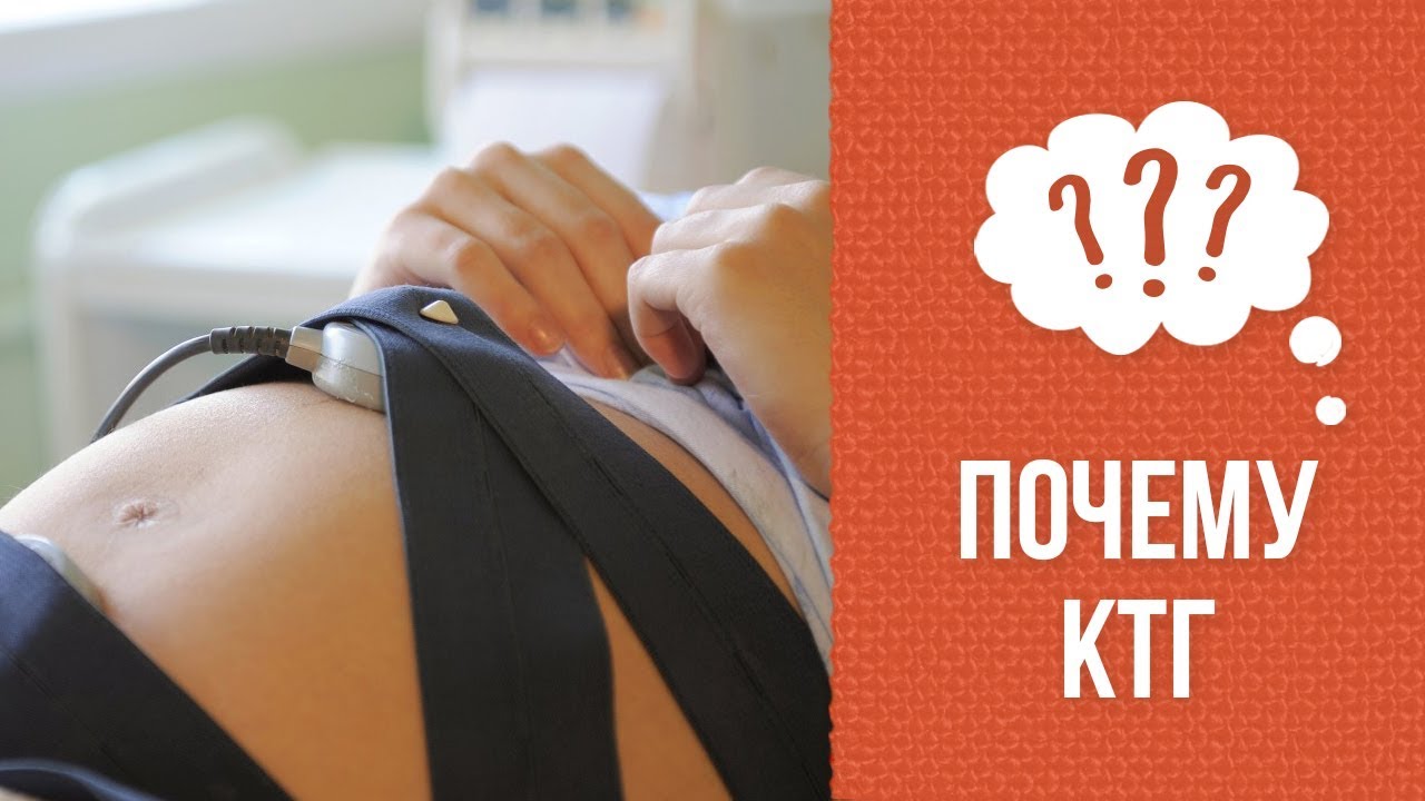Почему необходимо КТГ во время беременности? смотреть онлайн