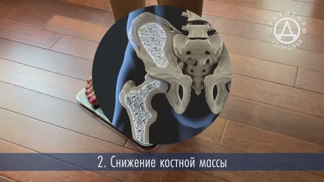 Витамин Д часть 1 - как заподозрить дефицит витамина Д смотреть онлайн