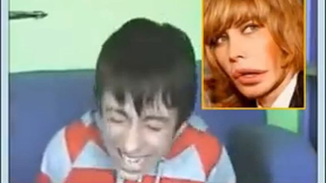 Зверев сделал очередную пластику лица??? смотреть онлайн