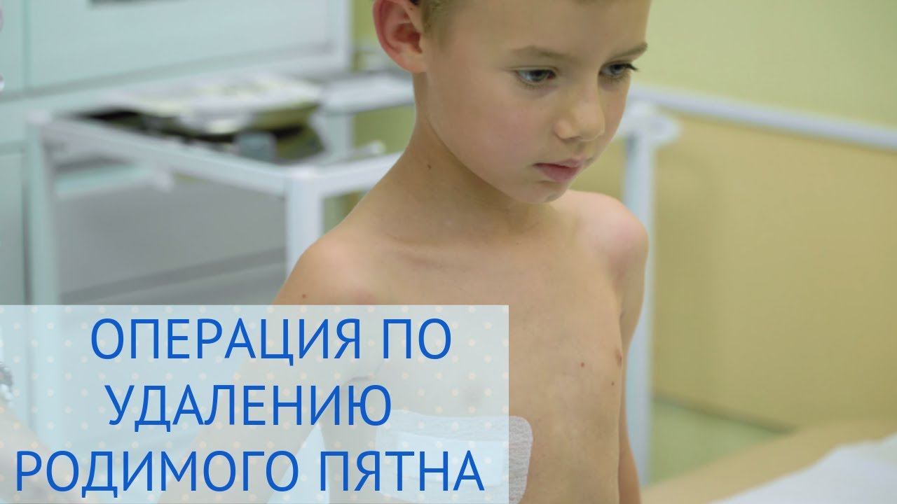 ⚕️ Операция по удалению родимого пятна в Европейском Медицинском Центре смотреть онлайн