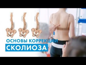 Сколиоз: диагностика, как подбирать упражнения, что помогает, а что нет | прямой эфир