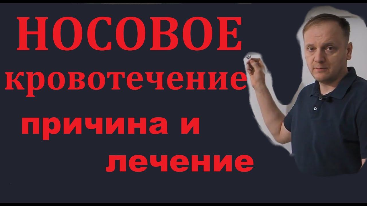 Носовое кровотечение | причина и лечение смотреть онлайн