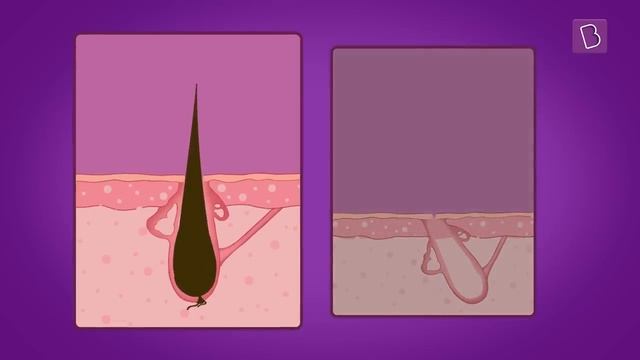 Why Do Some People Have Curly Hair? | BYJU'S Fun Facts смотреть онлайн