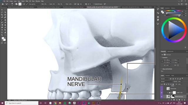 Medical illustration Photoshop tutorial: Filling holes with mixer brush tool смотреть онлайн