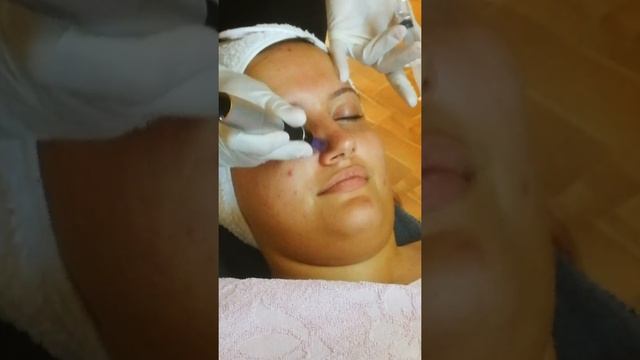 Фракционна мезотерапия - обучение смотреть онлайн