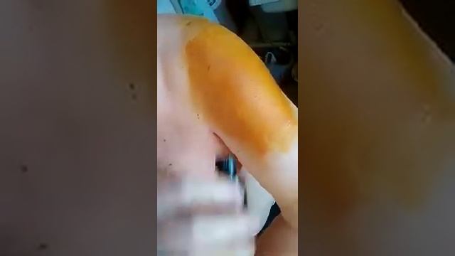 как использовать йод наружно каждый день смотреть онлайн