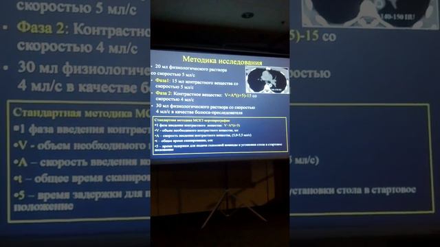 МСКТ кор в оценки анатомии вен сердца смотреть онлайн