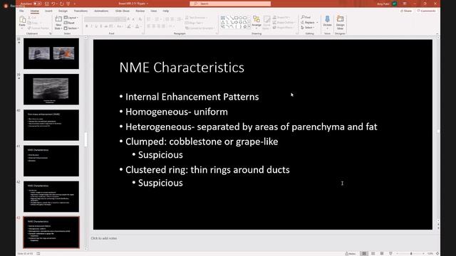 PART-2 MRI BREAST FINDING TYPES & MANY MORE смотреть онлайн