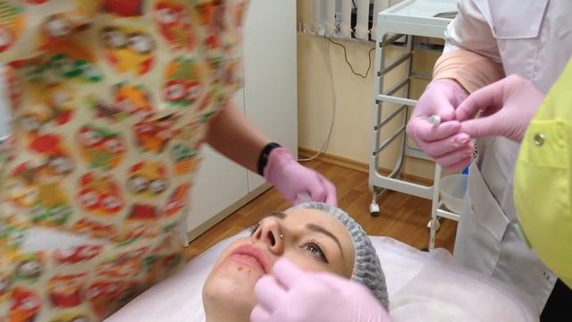 АирисКом студенты учатся: занятие по коррекции формы губ филлером средней плотности.