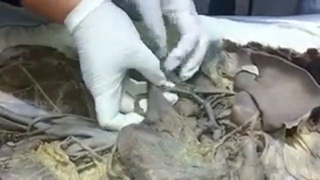 Анатомия человека. Артерии и вены. смотреть онлайн