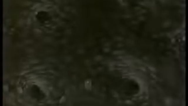 Анатомия 3 Пищеварение в желудке 1 смотреть онлайн