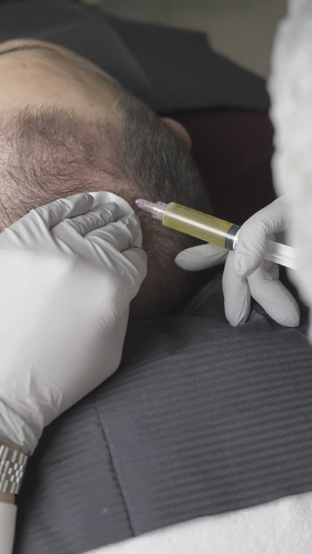 Восстановление кожи головы после пересадки волос смотреть онлайн