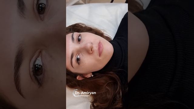 Сложные губы/ увеличение губ/ косметолог спб смотреть онлайн