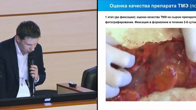 III конгресс РОСКР. Н.А.Козлов: Препарат-ориентированная хирургия смотреть онлайн