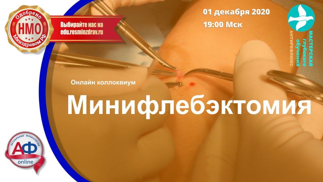 Минифлебэктомия. Онлайн коллоквиум смотреть онлайн