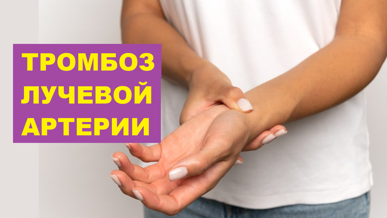 Тромбоз лучевой артерии
