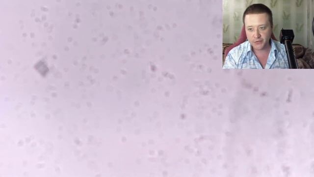 Лишайники, чайный гриб и пекарские дрожжи. Часть 2. Микроскопирование (скучно) смотреть онлайн