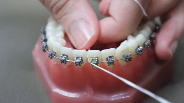 The Secret Alternative to Flossing смотреть онлайн