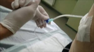 Санация дренажа