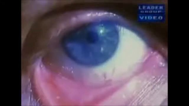 ПАРАЗИТЫ ВО ВСЁМ ТЕЛЕ!!!  СМОТРЕТЬ ВСЕМ!!!