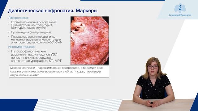 Амбулаторное ведение больных сахарным диабетом. Часть 1