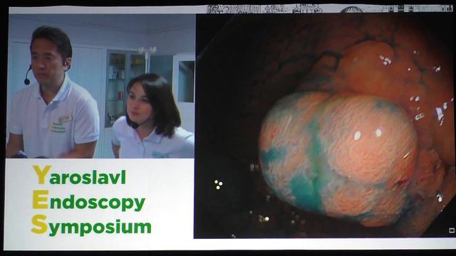 09Live Yutaka Saito EMR T1N0M0 слепой кишки смотреть онлайн