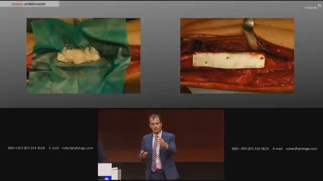 Dr. Dennis Rohner: Master the challenges in reconstructive surgery | Nobel Biocare смотреть онлайн