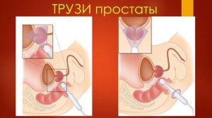 УЗИ простаты. УЗИ в урологии - 2021. Станислав Феданов