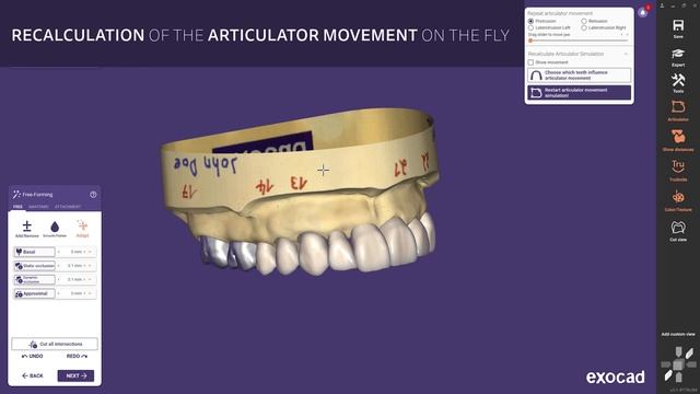 Simplify your design journey with exocad's DentalCAD 3.1 Rijeka смотреть онлайн