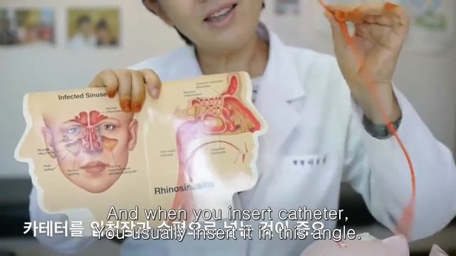 축농증 자가관리를 위한 비강습부요법 (Self suction) смотреть онлайн