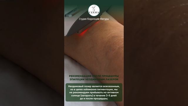 ЛАЗЕРНАЯ ЭПИЛЯЦИЯ⚡️#неодимовыйлазер