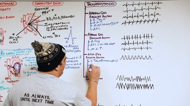 Arrhythmias | Types, Pathophysiology, Diagnosis, Treatment