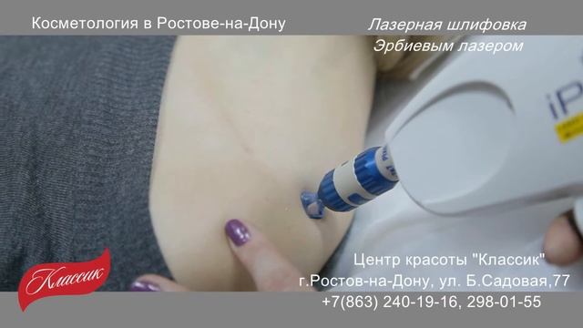 Лазерная шлифовка Эрбиевым лазером смотреть онлайн
