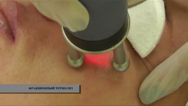 Фракционный Термолиз смотреть онлайн