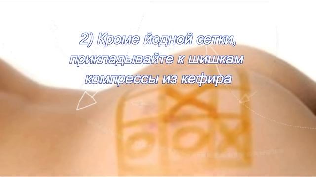 Шишки после уколов смотреть онлайн
