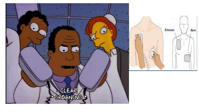 REANIMACIÓN CARDIOPULMONAR смотреть онлайн