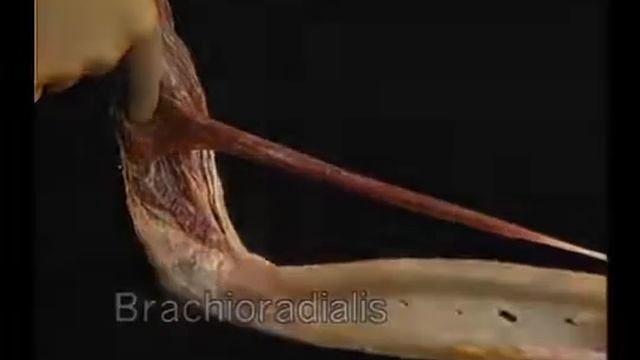 3 Плечо и предплечье смотреть онлайн