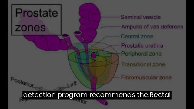 Digital Rectal Examination For Prostate Cancer Screening And Surveillance Is Called Into Question.