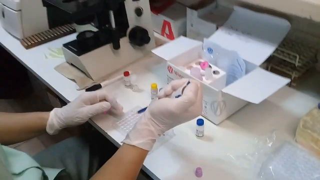 Act 3. Hemaglutinación: Toxo HAI смотреть онлайн